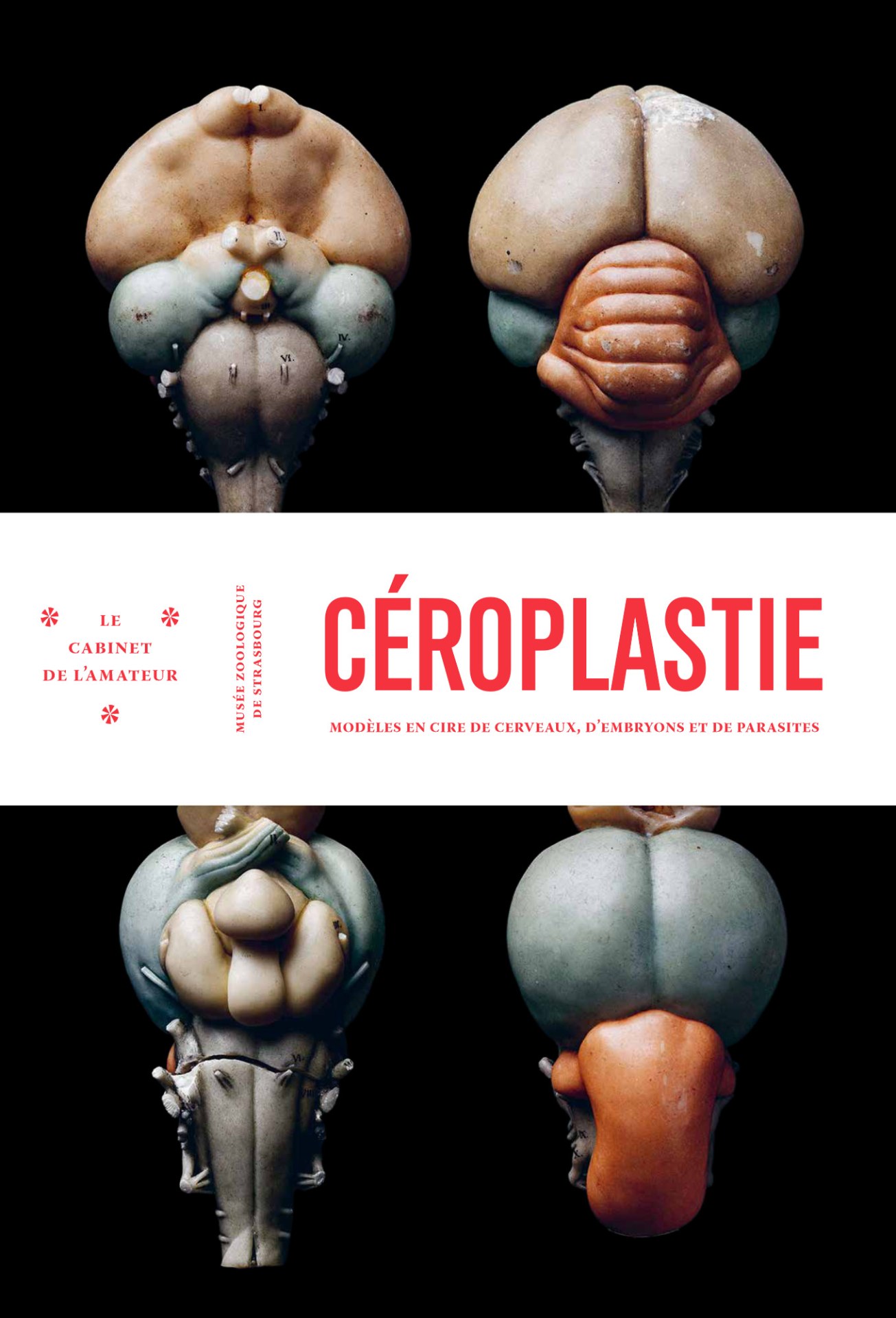 Céroplastie